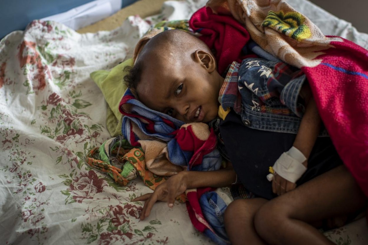 Sever Etiópe sužuje hladomor, kríza je vážna
