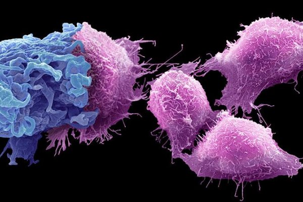 Ako funguje imunita, čo má spoločné s rakovinou a ako súvisí s hygienou a alergiami?